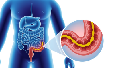 Human digestive system, with magnified view of intestinal lining and yellow structure, cutout, PNG isolated on white or transparent background