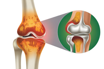 Human knee joint anatomy, showing bone structure and cartilage detail, cutout, PNG isolated on white or transparent background