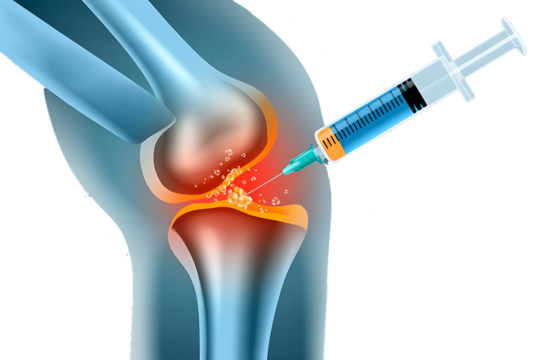 Knee joint, receiving an injection of fluid, cutout, PNG isolated on white or transparent background