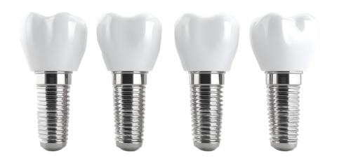 Four pristine white dental implants with detailed metallic screw bases stand ready for restoration and health