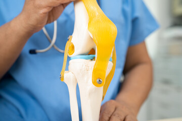 Osteoarthritis of the knee, Doctor holding human knee joint orthopedic anatomy model in hospital.