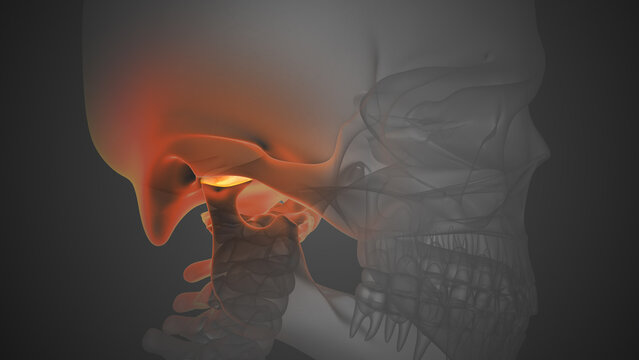 Jaw Joint Inflammation Causing TMJ Disorder Pain