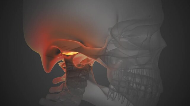 Jaw Joint Inflammation Causing TMJ Disorder Pain