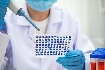 Scientist with cell culture in sample micro plate for research in science laboratory.