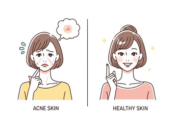 Comparison of a woman with acne skin and a woman with healthy skin, showing a transformation and improvement