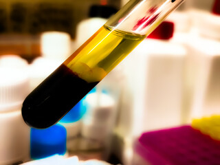 Serum and blood cell in glass test tube. It's a clear, yellowish fluid that remains after blood has clotted.