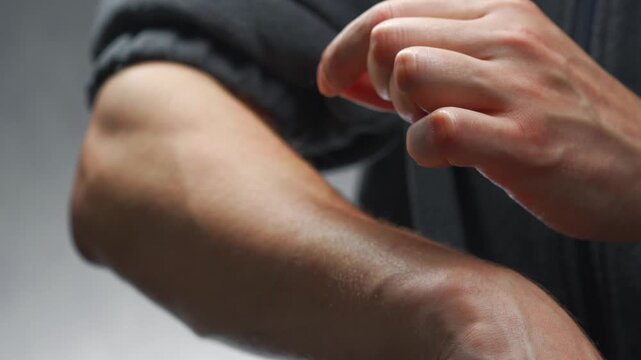 Tight skin on the arm.
Aging and sagging skin on the body
A person pinching the thin skin on the arm