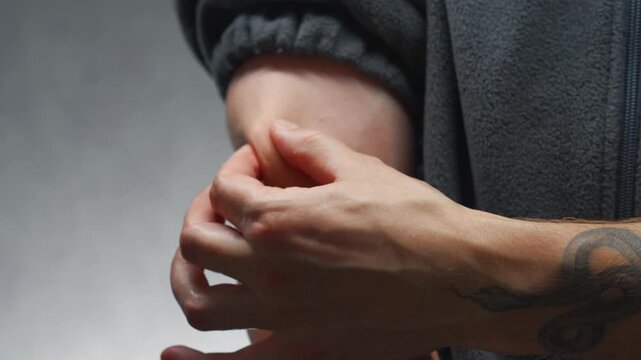 Tight skin on the arm.
Aging and sagging skin on the body
A person pinching the thin skin on the arm