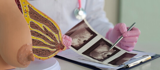 Mammologist examines photographs of female breasts and ultrasound results. Breast diseases concept