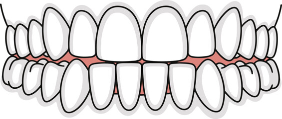 A flat vector illustration depicting the upper and lower dental arches with white teeth and pink gums, showing a Class I occlusal relationship.