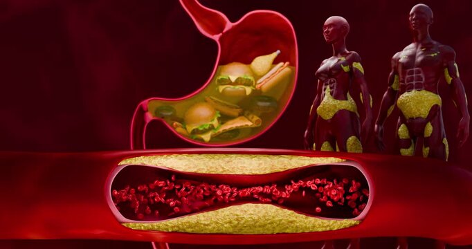 Health Concept of Obesity and Cardiovascular Risk from Visceral and Subcutaneous Fat Accumulation 3D Rendering
