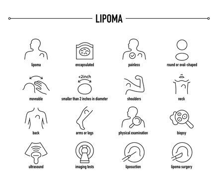 Lipoma symptoms, diagnostic and treatment vector icon set. Line editable medical icons.
