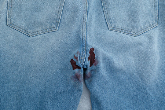 Menstruation or monthly cycle. Blood stain or Period stain on back of jeans, close-up. Aunt Flo is visiting. Crimson tide or Unexpected leak. Menstrual Trouble