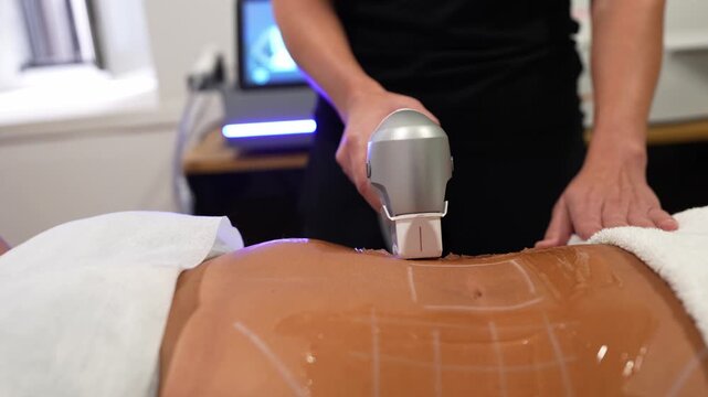 Beautician performing a non surgical hifu treatment on a woman's abdomen. Ultrasound therapy for body contouring and fat reduction