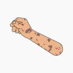 Vitiligo hand arm, gesture flat collage element vector