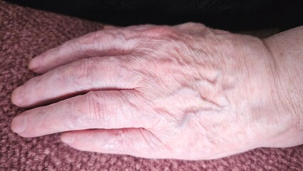 Fototapeta premium Close-up of a senior person's hand showing aged skin, wrinkles and veins. Natural texture, elderly care concept, health, human anatomy, detailed view, real life authenticity
