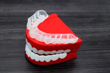 歯の矯正用のマウスピースと歯の模型
