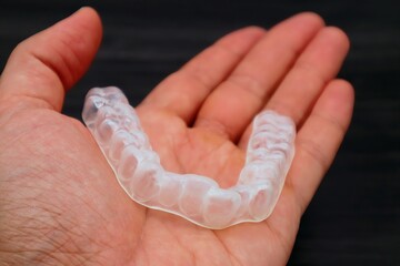 歯の矯正用のマウスピースを持つ人物のクローズアップ