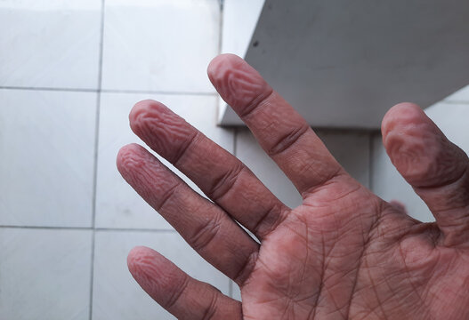 Close-up of wrinkled fingers and palms after long exposure to water, showing detailed skin texture and natural lines. Ideal for themes of skincare, moisture, aging, hygiene, and human anatomy.