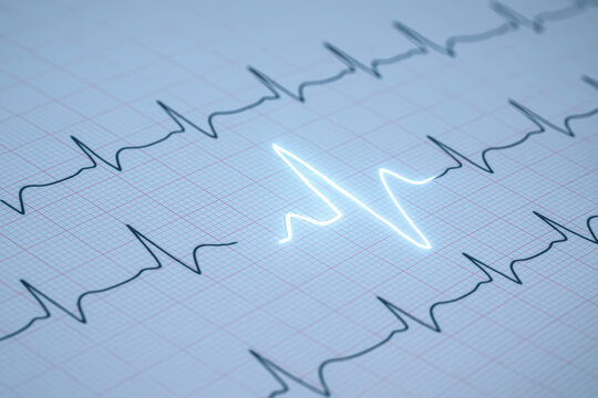 Cardiogram paper with glowing red neon heartbeat waveform, detailed close-up of ECG line on medical grid, heart health monitoring concep - Powered by Adobe