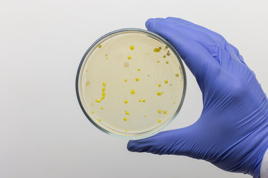 Yellow bacterial colonies on selective agar in a petri dish, close-up of a petri dish held by a scientist on a gray background.