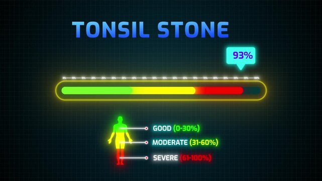 Tonsil Stone Severity Risk Meter Animation | Digital HUD with Percentage Counter and Human Silhouette Infographic 4k video