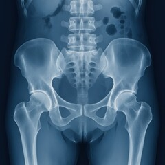 Human pelvis, hip joints, and lumbar spine x-ray medical scan