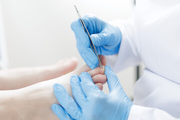 Podiatrist treating patient foot with gloves and instruments in medical setting
