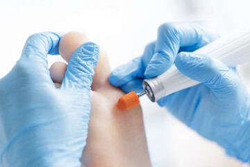 Professional pedicure treating foot with specialized tool in medical setting, white light background