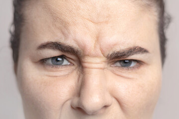 Caucasian woman shows her facial wrinkles on her face. Folds on the skin. Close up