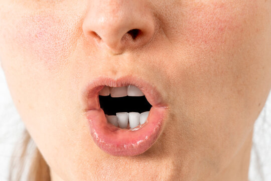 Screaming mouth expressing negativity, disapproval, mimic wrinkles. Face without makeup. Female hysteria