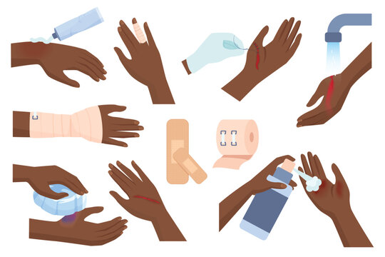 First aid for hand injury vector set vector illustration. Injured dark skin human arms of patient with wound and burn on skin, hands cleaning trauma with water, using elastic bandage and dressings