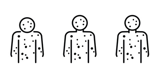 Smallpox. Skin rash, measles, irritation orallergic reaction.. Red rash on the body. food allergy orother autoimmune diseases. Rubeola or morbilli symptom. food allergy. Eczema, variola.