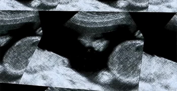 Close-up medical ultrasound image capturing fetus at three months during standard pregnancy checkup