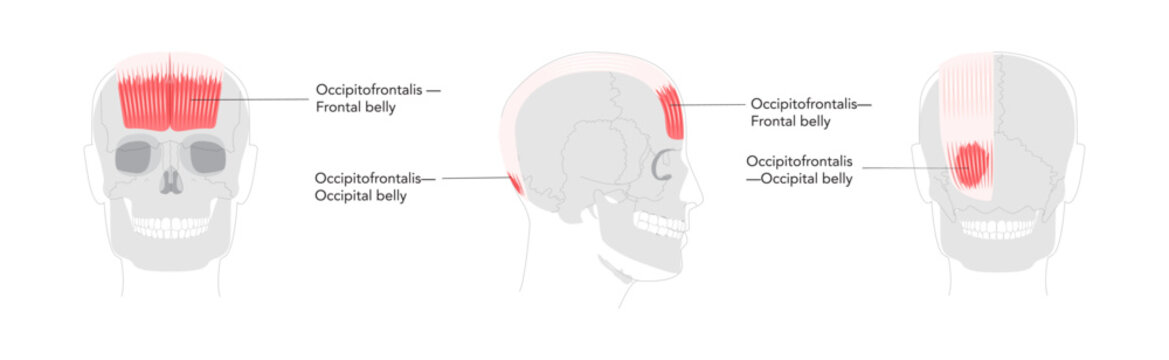 Occipitofrontalis - Human scalp muscle that raises the eyebrows and wrinkles the forehead, depicted in detailed labeled anatomy chart, medical and educational reference.