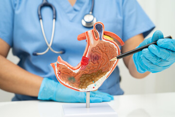 Stomach disease, doctor holding anatomy model for study diagnosis and treatment in hospital.