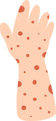 Human hand and arm covered in red skin rash spots. Allergic reaction, infection, or disease symptom. Flat vector illustration.