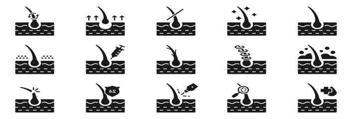 Hair Loss, Growth, Transplant, Removal, Care Silhouette Black Icon Set. Healthy Dermatology Therapy for Epidermis Glyph Pictogram. Hair Follicle Treatment Icon. Isolated Vector Illustration.