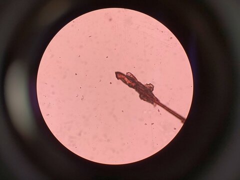 Demodex Mite Viewed Under a Microscope 