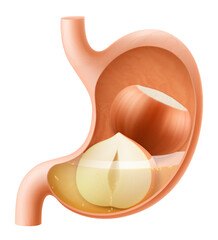 Human Stomach with hazelnuts. The stomach digests hazelnut. A stomach filled with healthy food with protein. Proper nutrition. Realistic 3d Vector illustration. Food digestion process illustration