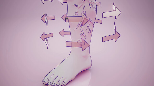 Conceptual 3D illustration of a leg with varicose veins