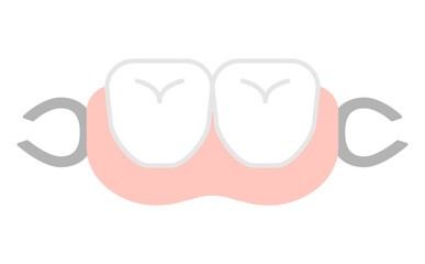 歯の矯正や部分入れ歯の介護イラスト Orthodontic Braces Illustration