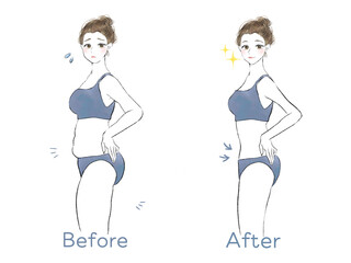 ビキニ女性のダイエットビフォーアフターイラスト