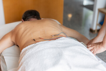 Acupuncture therapy session with electroacupuncture on back at clinic