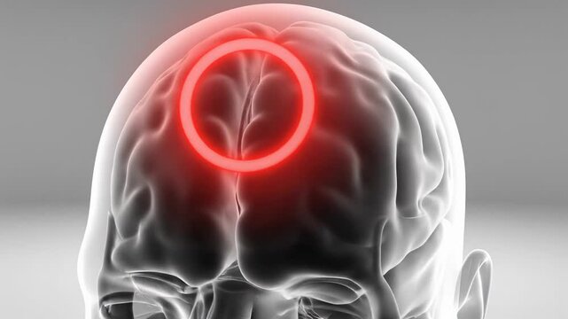 Brain Pain and Headache - 3D Animation of Human Head with Highlighted Brain Area Indicating Pain.