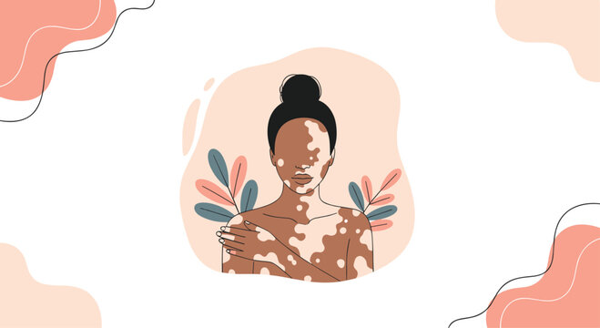 A serene portrait of a young woman with vitiligo embracing self-love and body positivity, surrounded by delicate foliage and soft colors. - Powered by Adobe