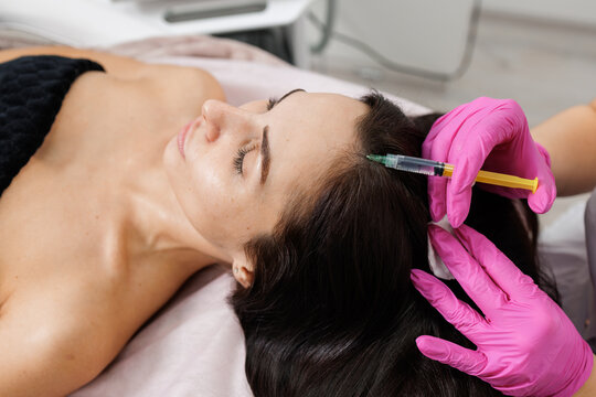 Scalp mesotherapy injection for female hair loss and hair growth stimulation
