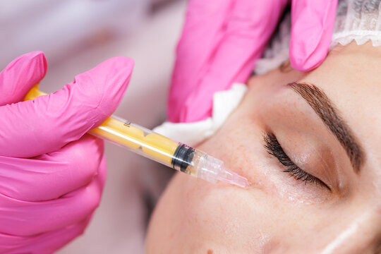 Closeup under eye mesotherapy bioreparation injection in aesthetic dermatology clinic