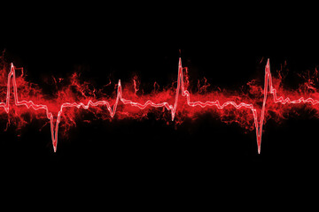 ECG electrocardiogram