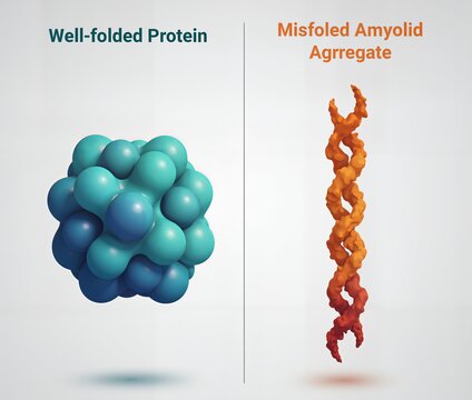 Comparison of a well-folded functional protein (blue) and a misfolded toxic Amyloid Aggregate (orange/red). Illustrates proteinopathy and neurodegeneration.